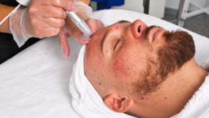 Cosmetic chemistry and advanced treatment techniques