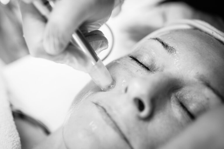The science of microneedling – From injury to regeneration