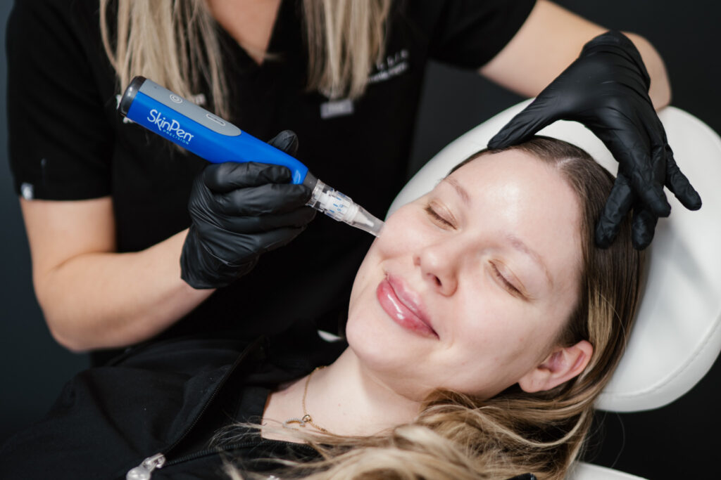 Videnskaben om microneedling – Fra skade til regeneration