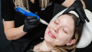 The science of microneedling – From injury to regeneration