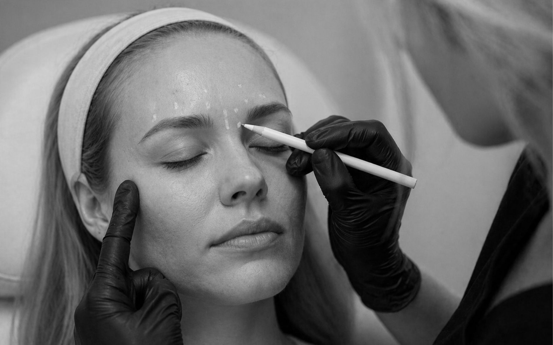 Botulinumtoxin Demonstration - 3 områden: Pannmuskel, Bekymmersrynkan och Vargtanden, Ögonringmuskel