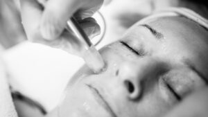 The science of microneedling – From injury to regeneration