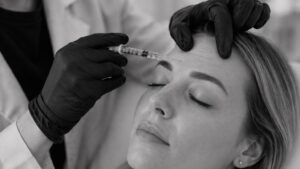 Botulinum Toxin: From Wrinkle Reduction to Advanced Facial Modulation